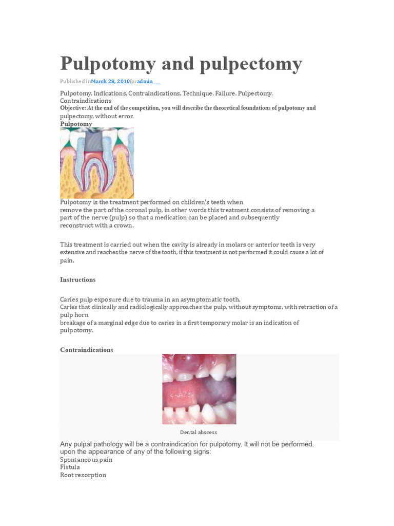 Pulpotomy and Pulpectomy | PDF | Medical Specialties | Mouth