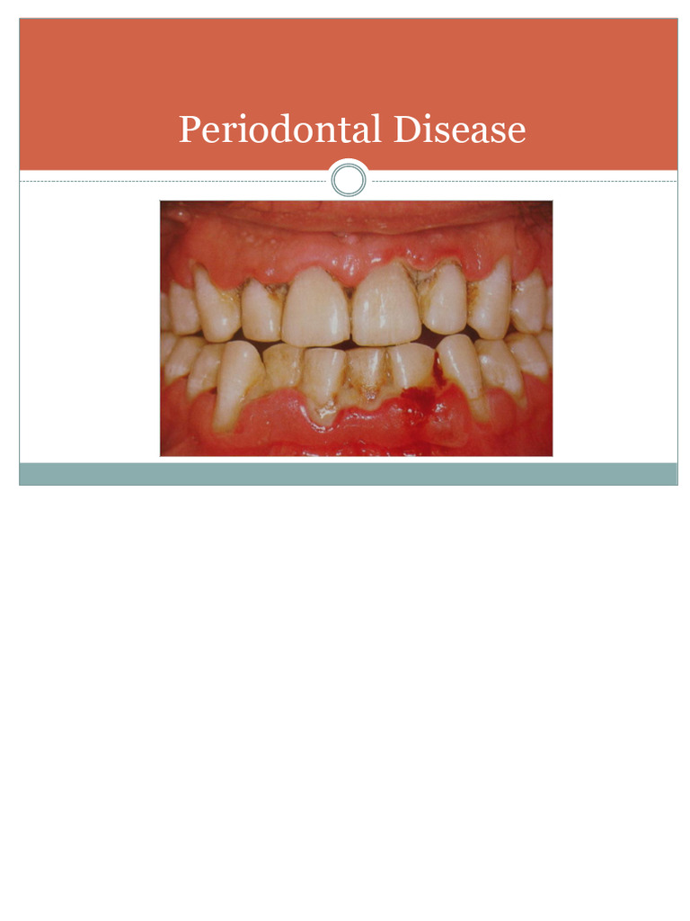 CLASS Periodontology | PDF | Periodontology | Human Tooth