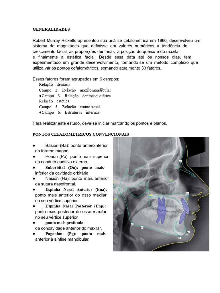 Análise Cefalométrica de Ricketts | PDF