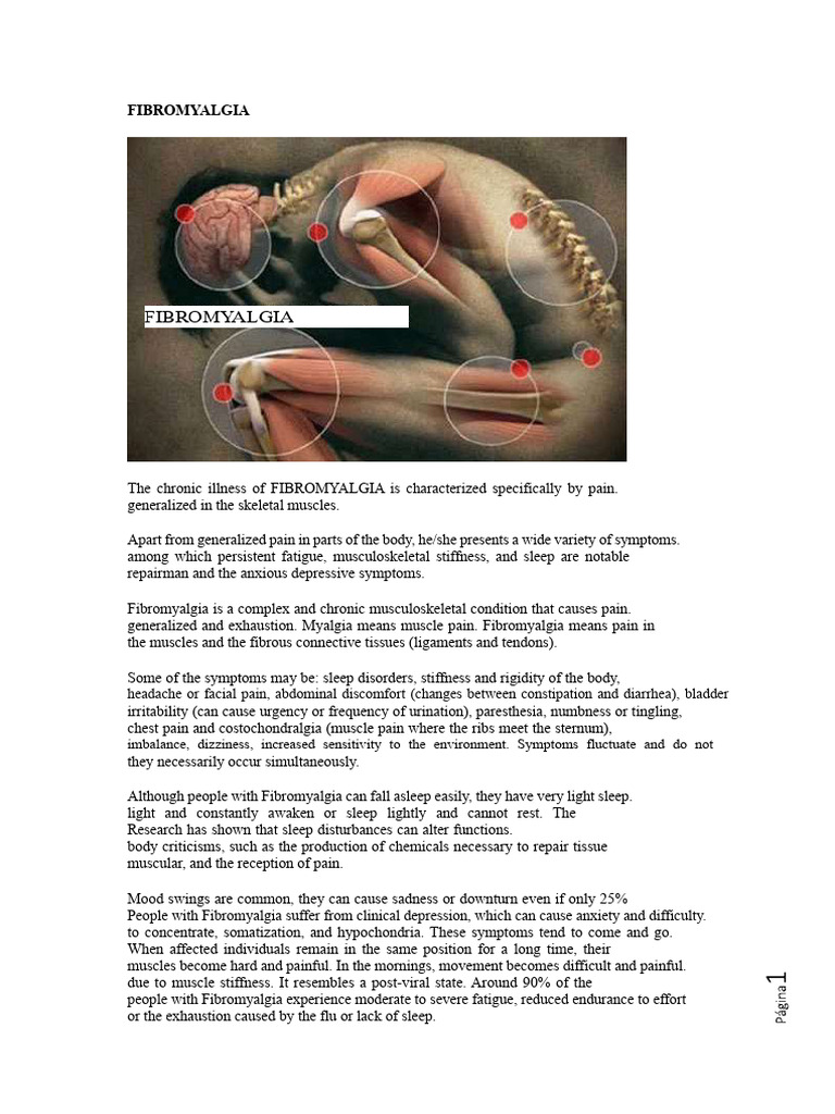 FIBROMYALGIA | PDF | Malaria | Fibromyalgia