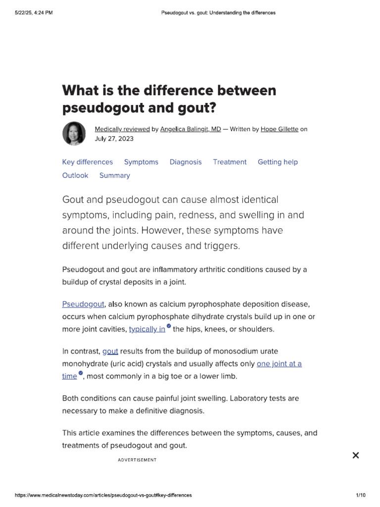 What Triggers Pseudogout? Exploring the Underlying Causes