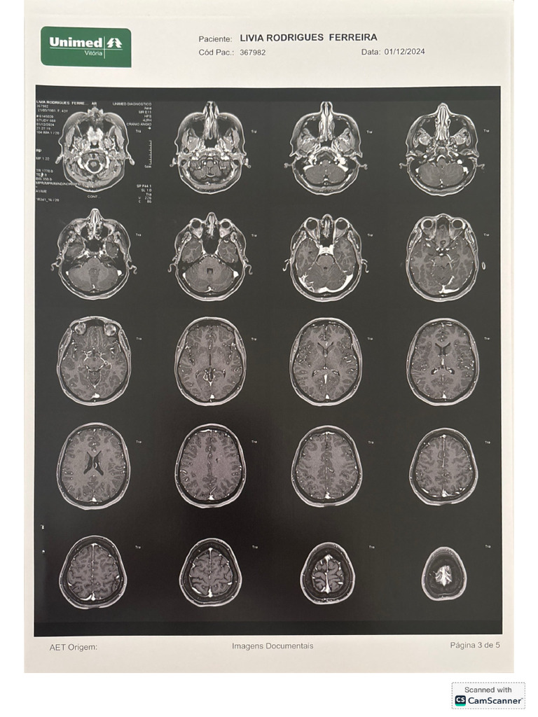 Ressonante Crânio Lívia | PDF