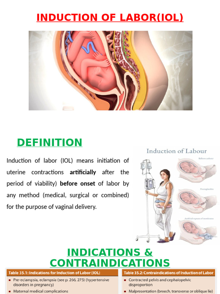 Induction of Labor: Methods & Guidelines | PDF | Childbirth | Motherhood