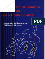 Tratamiento Ortodontico Denticion Mixta Mcnamara