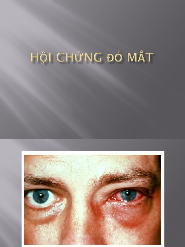 Do Mat | PDF