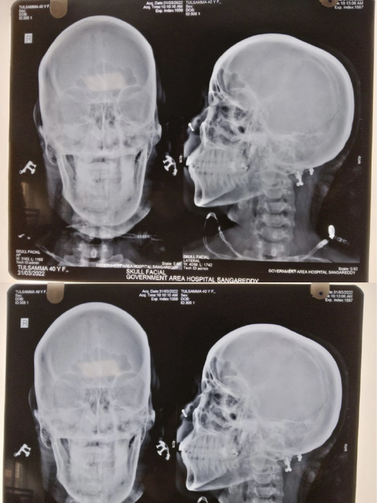 X Rays | PDF