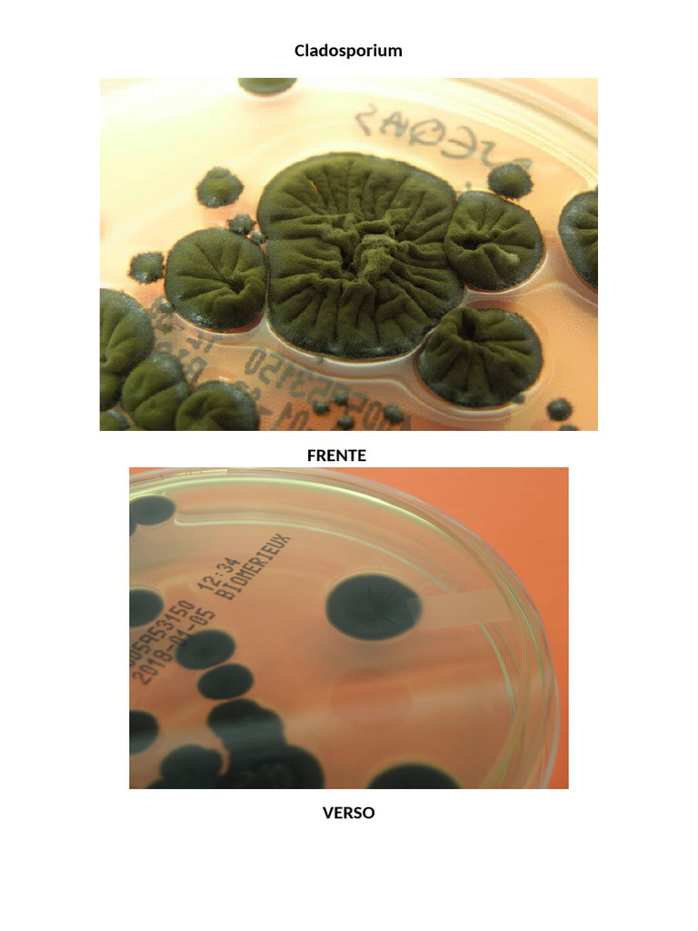 Cladosporium | PDF