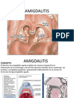 AMIGDALITIS OTORRINO