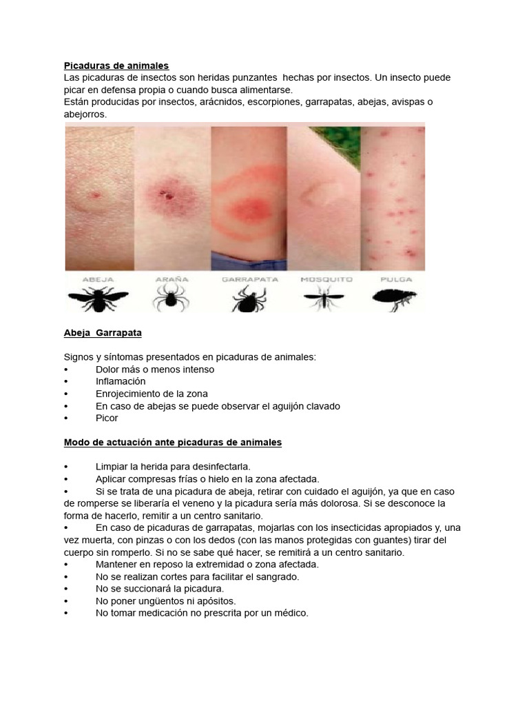 Guía de primeros auxilios: picaduras y mordeduras | PDF | Herida | Insectos