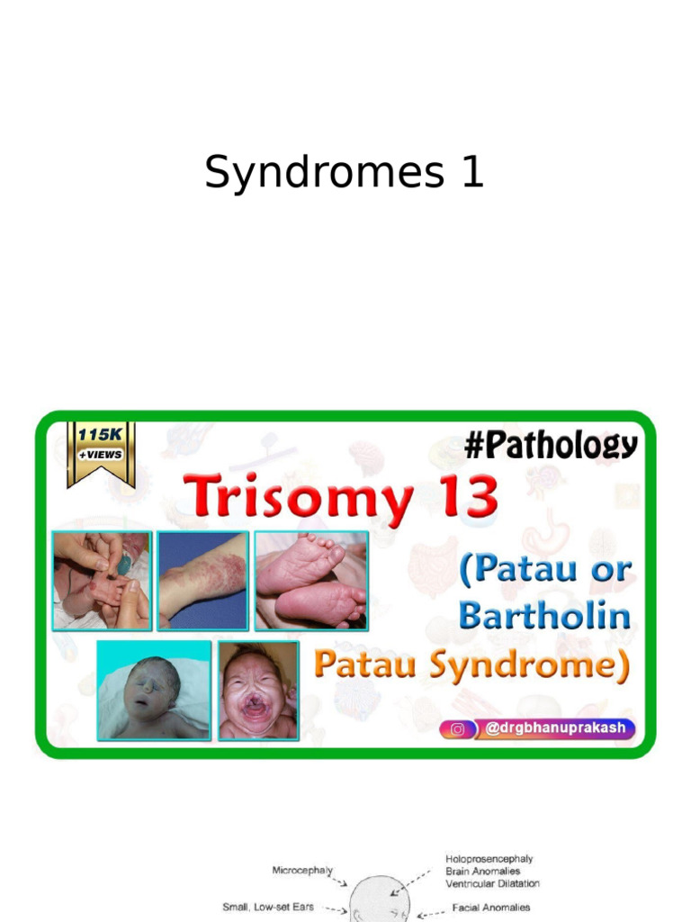 Syndromes | PDF