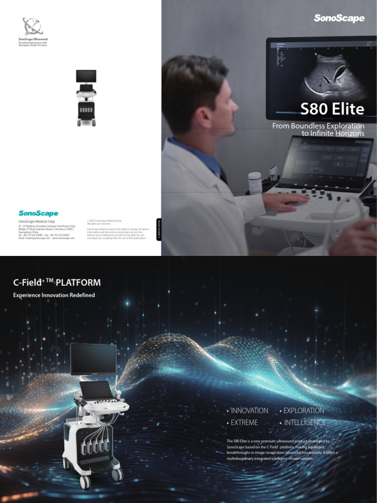 S80 Elite Ultrasound Brochure | PDF | Medical Imaging | Medical Diagnosis