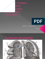 Derrame Pleural