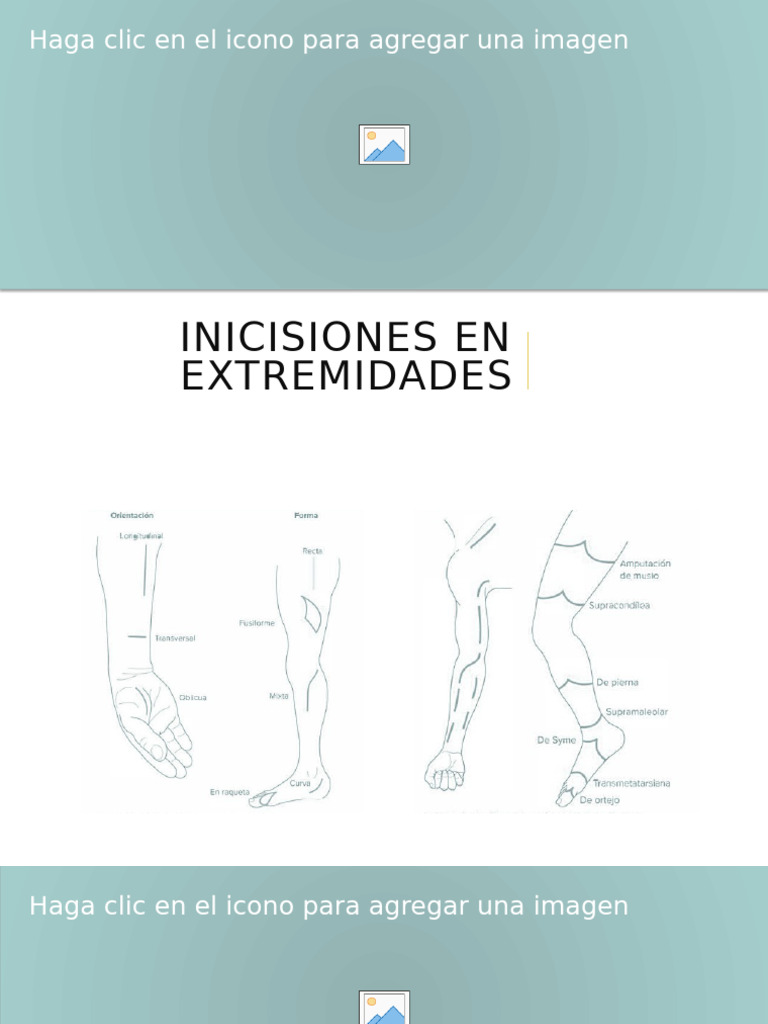 Tipos de Incisiones Quirúrgicas Detalladas | PDF | Abdomen | Anatomía