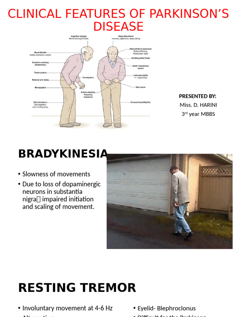 Clinical Features of Parkinson's Disease | PDF | Parkinson's Disease ...