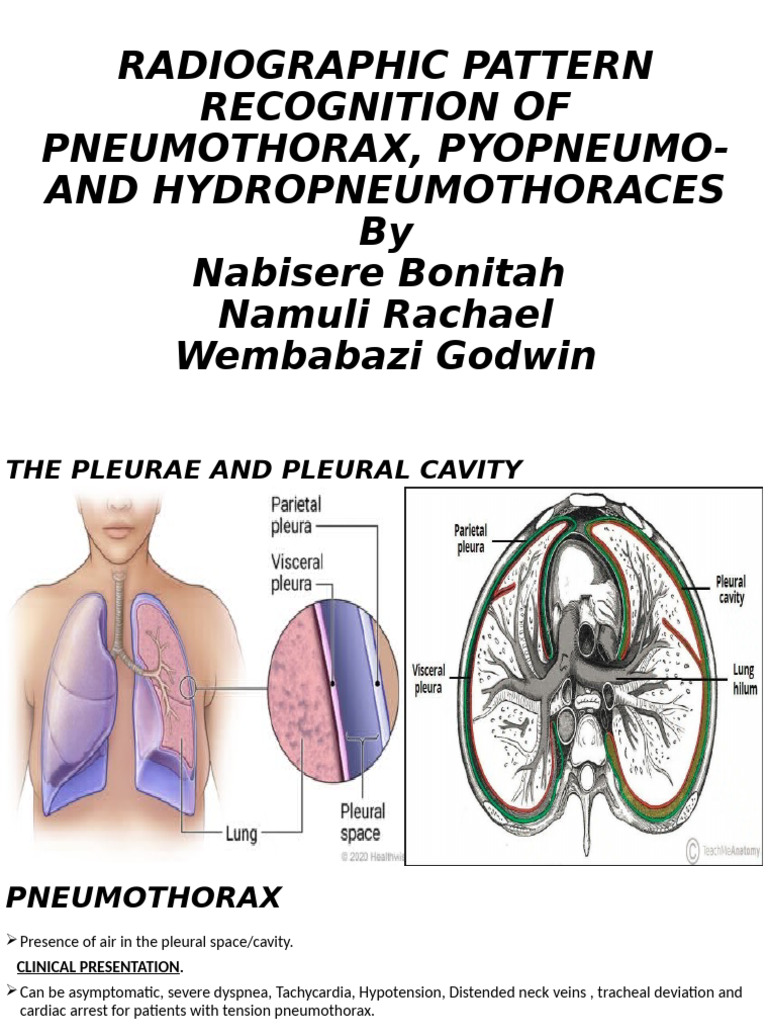Radiographic Patterns of Pneumothorax | PDF | Lung | Thorax