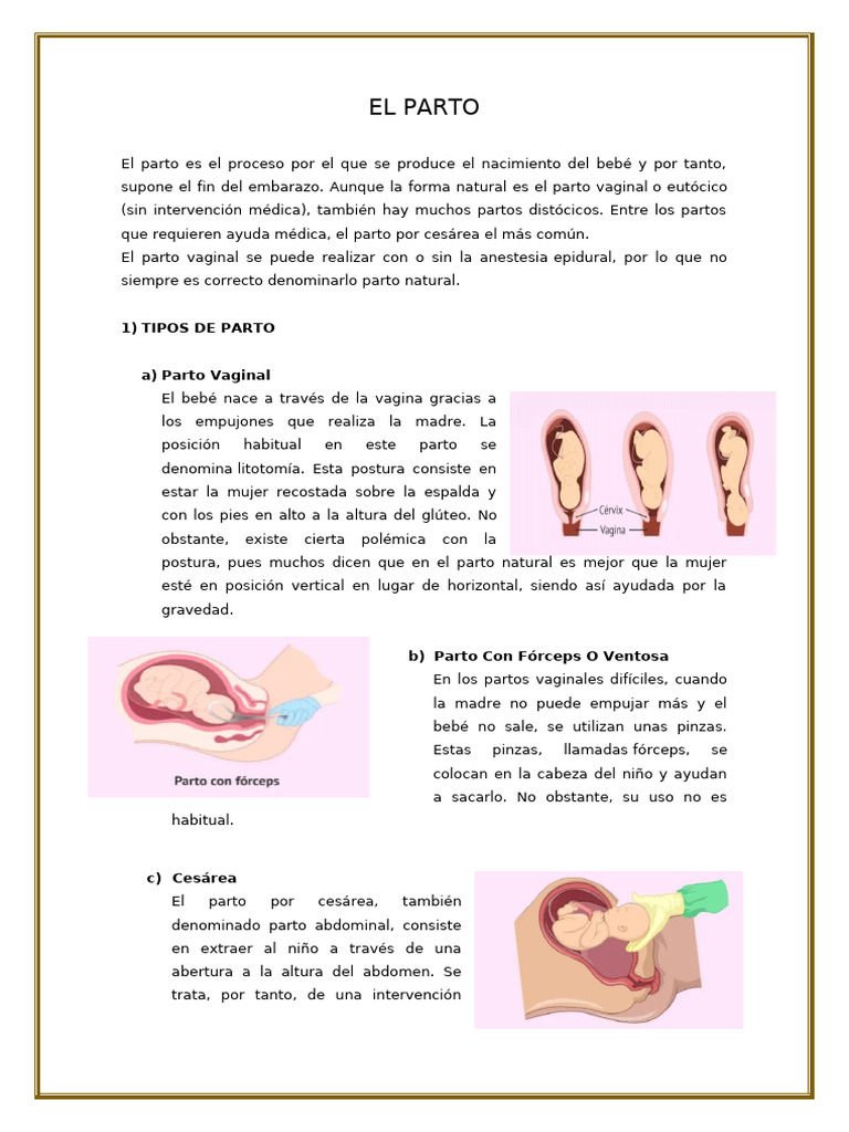Tipos y Proceso del Parto: Guía Completa | PDF | Parto | Seccion de cesárea