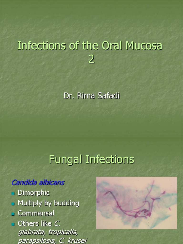 Infections of The Oral Mucosa 2 (Slide 12 +13) | PDF