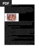 Download Askep Pada Pasien Kanker Ovarium by Willy WillyamIskandar SN92485611 doc pdf