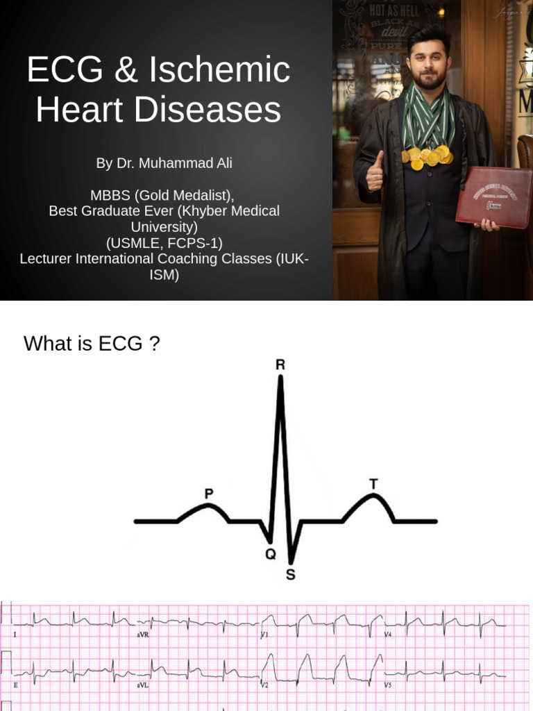 ECG & Ischemic Heart Diseases 3 | PDF