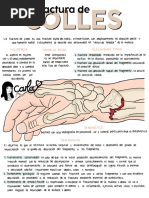 Fractura de Colles: Diagnóstico y Tratamiento | PDF | Mano | Osteoporosis