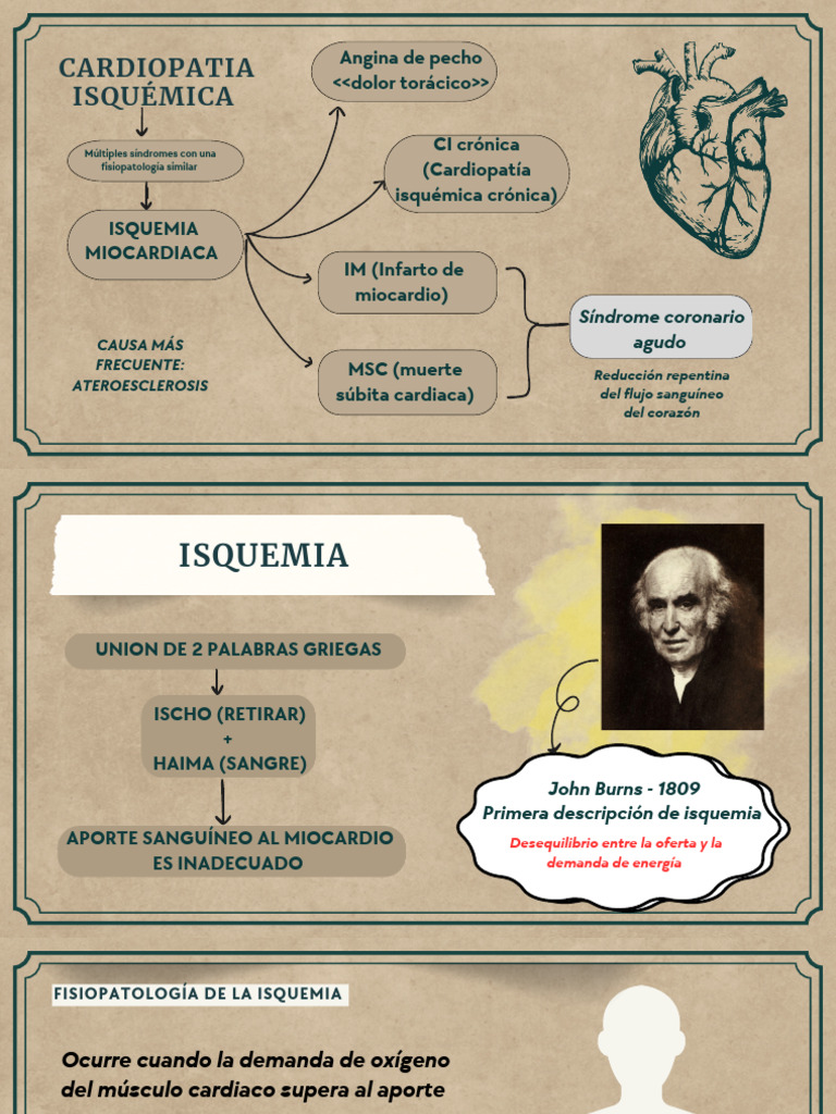Isquemia Cardiaca | PDF | Infarto de miocardio | Isquemia