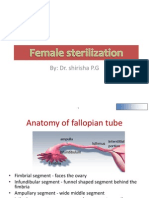 Female Sterilization