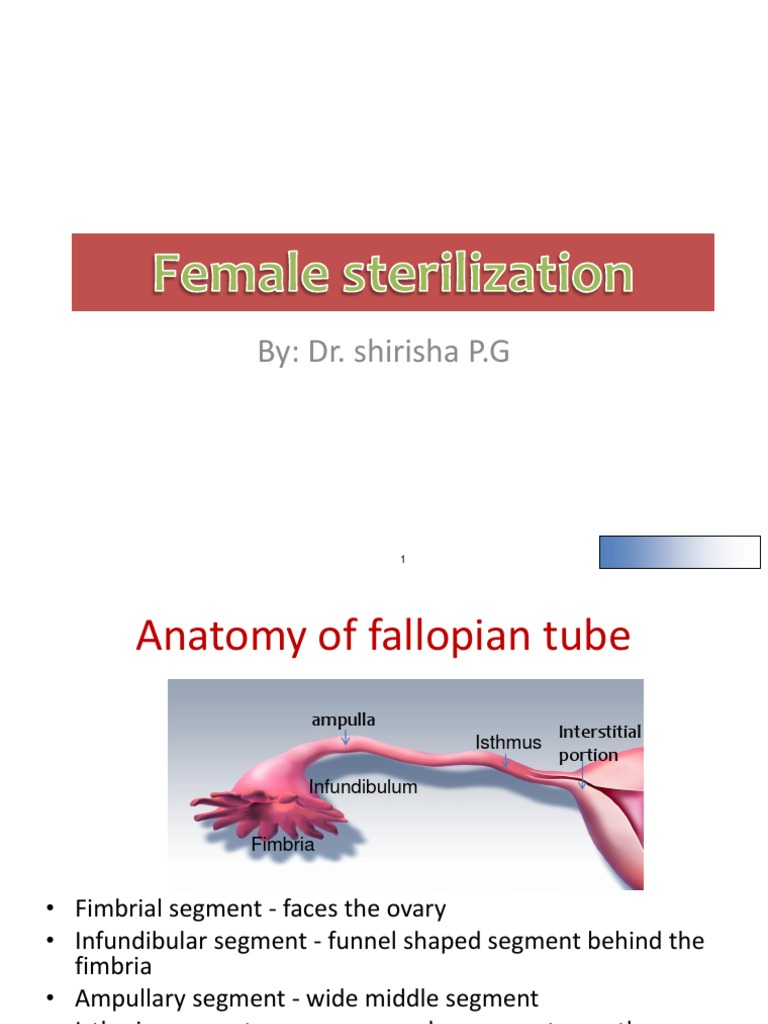 Female Sterilization Medical Specialties Women's Health