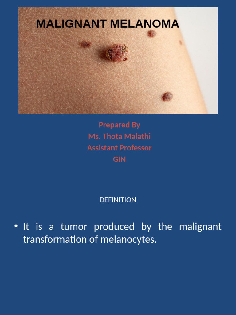 Malignant Melanoma | PDF