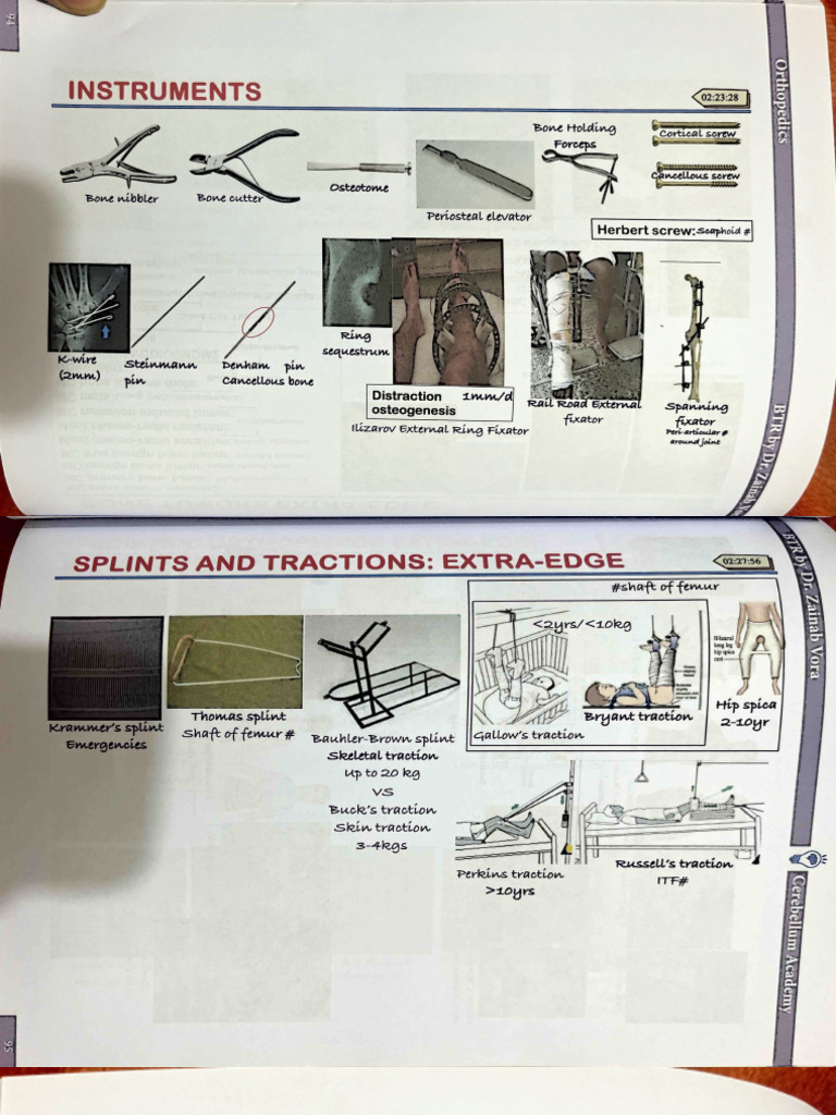 Orthopedic Instruments and Techniques | PDF