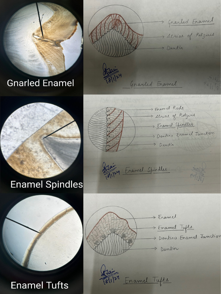 Enamel (D+S) | PDF