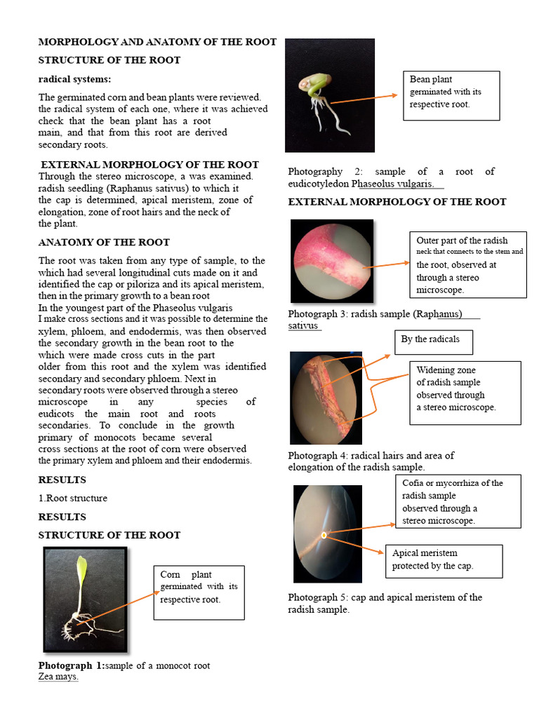 Root Morphology and Anatomy Overview | PDF | Root | Plant Physiology