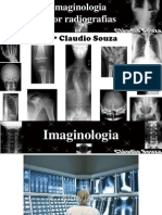Aula 1 - Imaginologia por radiografias, mao, punho, cotovelo e antebraço. Profº Claudio Souza- ATUALIZADA mês05/12!!!!