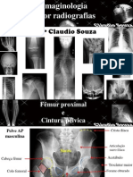 aula 4- Imaginologia por radiografias- Femur e cintura pelvica. Profº Claudio Souza- ATUALIZADA mês05/12!!!!