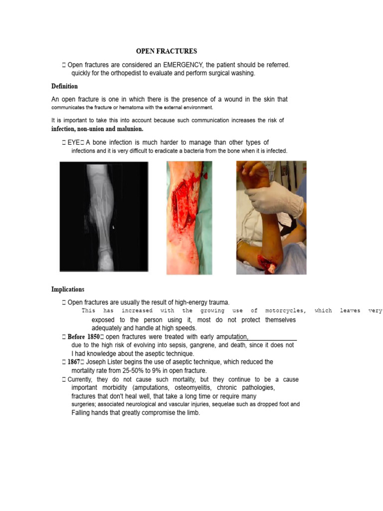 Open Fractures | PDF | Wound | Clinical Medicine