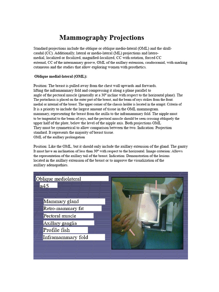 Mammography Projection Techniques Explained | PDF | Breast | Mammography