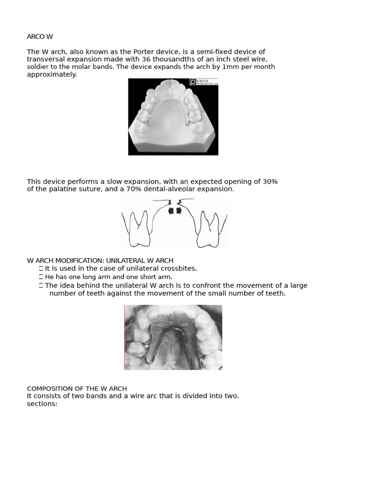 W Arch Appliance Overview and Use | PDF | Orthodontics | Dentistry Branches