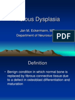 Fibrous Dysplasia
