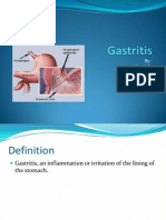 GASTRO - Gastritis