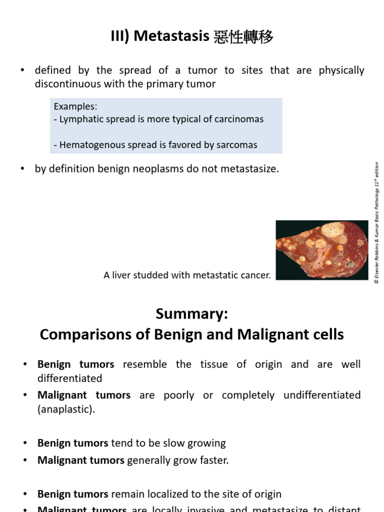 Cancer Metastasis and Staging Overview | PDF | Coagulation | Platelet