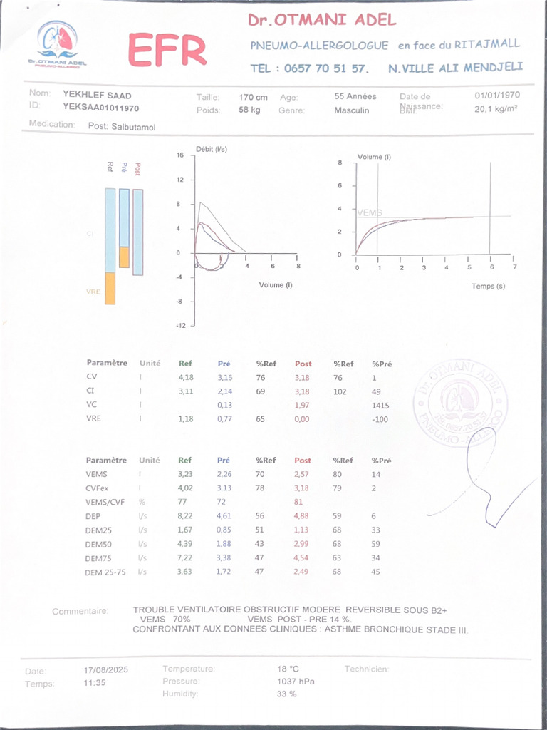 Efr | PDF