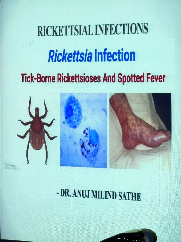 Rickettsia Infection | PDF