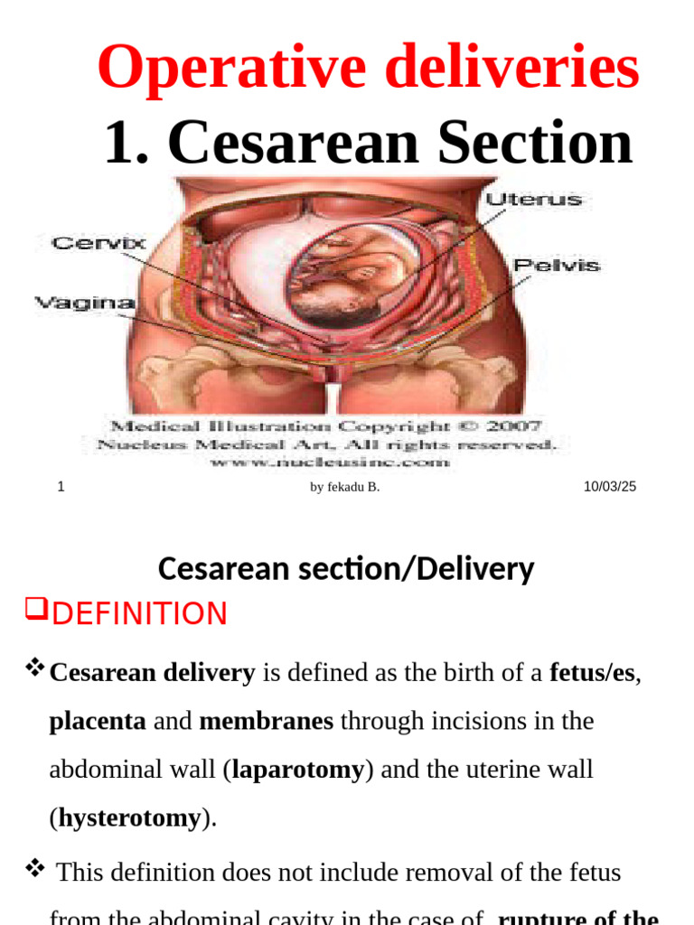 Cesarean Section | PDF | Caesarean Section | Uterus