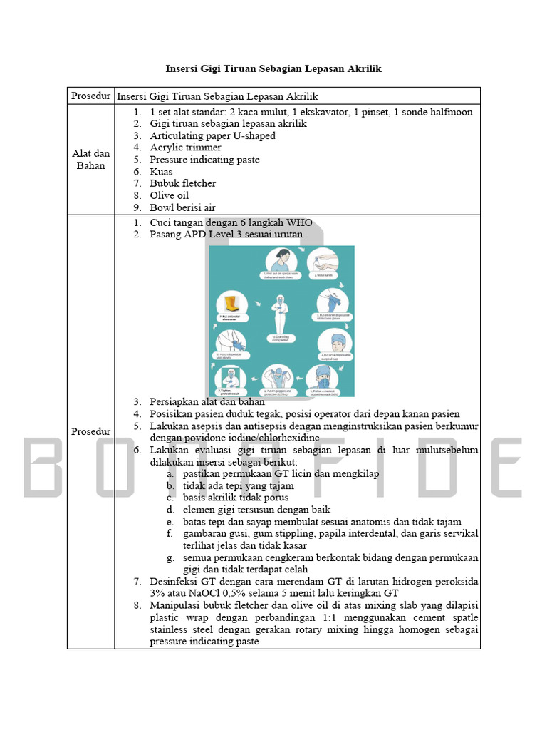 Prosedur Insersi Gigi Tiruan Akrilik | PDF