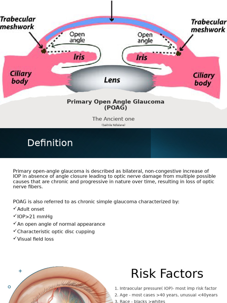 Primary Open Angle Glaucoma | PDF | Glaucoma | Ophthalmology