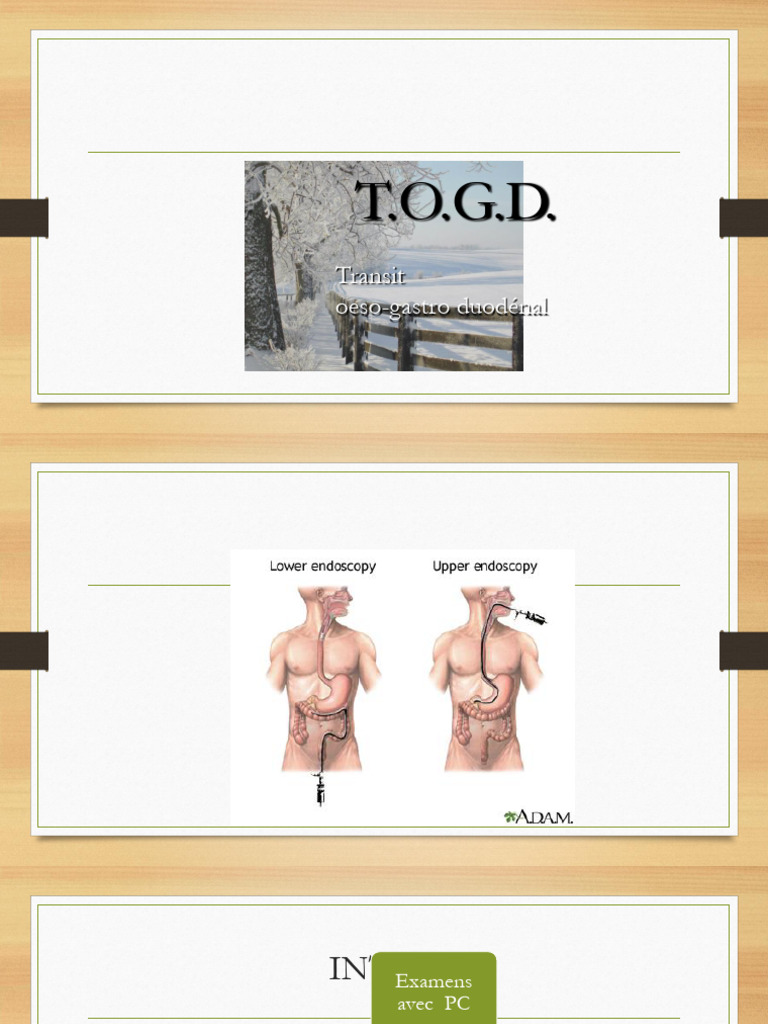 Transit Œso-Gastro-Duodénal | PDF | Estomac | Endoscopie