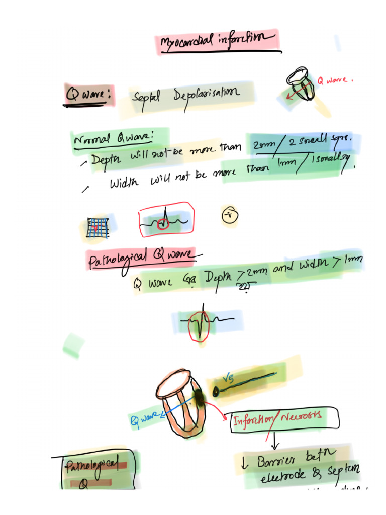 Myocardial Infarction | PDF