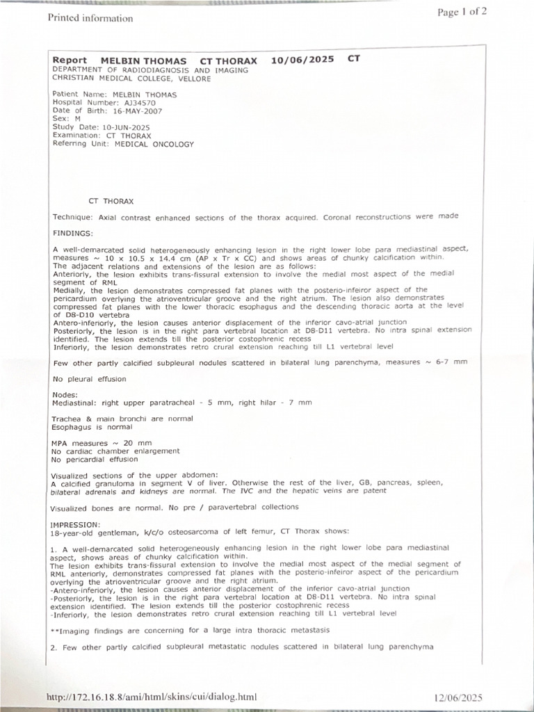 CT Report | PDF