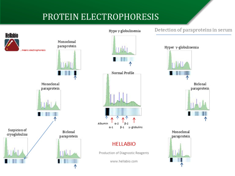 Protein Electrophoresis Overview | PDF