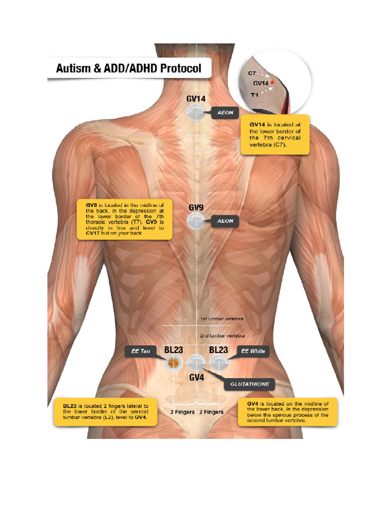 Puncte de Aplicare Protocol - Autism Si ADHD | PDF