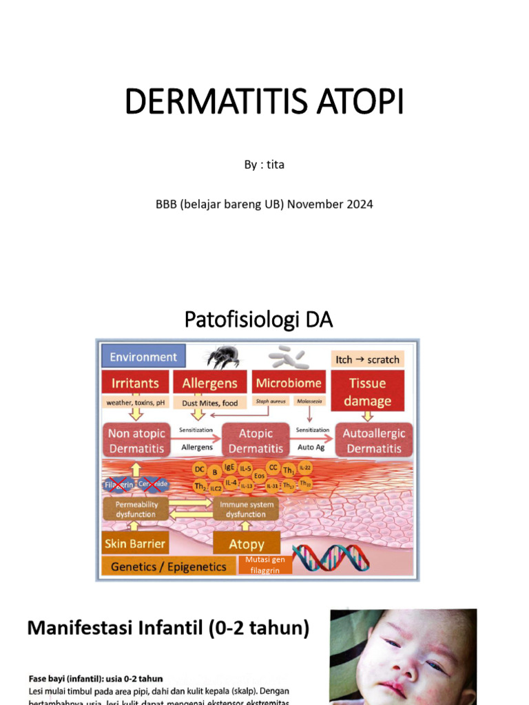 Dermatitis Atopi (Watermark) | PDF